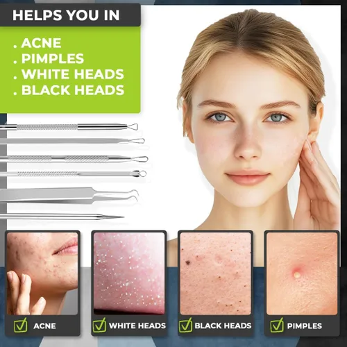 Vista 2 de [6 Piezas] Herramientas para Eliminar Puntos Negros para el Acné - Kit de Herramientas de Acero Inoxidable Quirúrgico para Reventar Espinillas, Kit