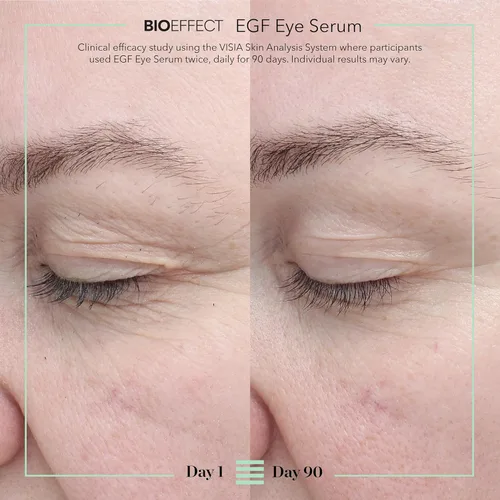Vista 3 de BIOEFFECT EGF - Suero para ojos con rollerball antiinflamador Tratamiento debajo de los ojos que desafía la edad con factor de crecimiento