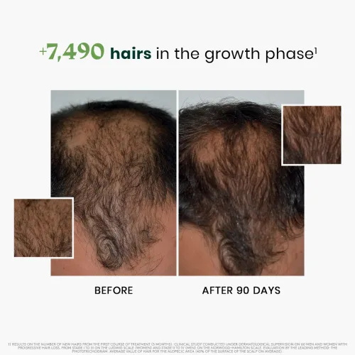 Vista 3 de Suero concentrado progresivo trifásico de René Furterer para el adelgazamiento del cabello hereditario y hormonal - Sin medicamentos - Línea