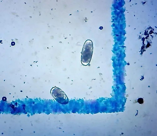 Vista 4 de Paquete de 2 portaobjetos de microscopio McMaster, FEC (recuento de huevos fecales) de doble cámara para pruebas de parásitos, huevos de parásitos