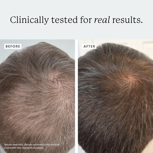 Vista 4 de Multivitaminas para el cabello de biotina, 2500 mcg de biotina con colágeno, 60 cápsulas, suministro para 30 días