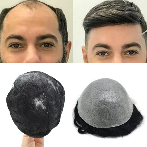 Vista 47 de Toupee - Sistema de reemplazo de piezas de cabello humano real, piel ultrafina, para hombres, cabello indetectable, línea capilar natural