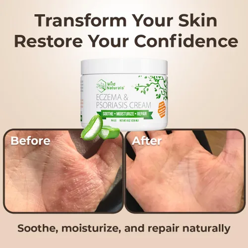 Vista 5 de Crema Wild Naturals para eccema y psoriasis con miel de manuka + aloe vera + manteca de karité + aceite de coco + aceite de cáñamo, 1, 1