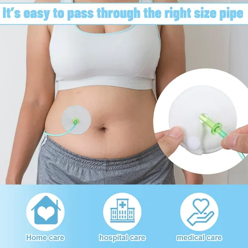 Vista 2 de Sosation Paquete de 56 fundas para botones para tubo G, suministros de alimentación abdominal peritoneal, almohadillas de algodón suave