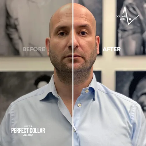 Vista 5 de Collar Dots Estadías de cuello para camisas de vestir y polos para hombre. Hack de moda para plástico, metal y cuello magnético, permanece 24 horas