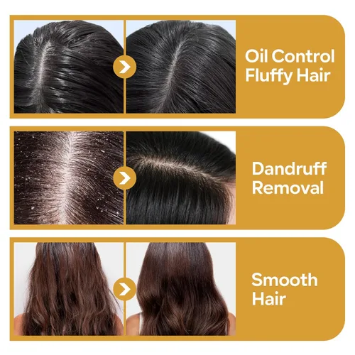 Vista 5 de KYDA Paquete de 3 barras de champú para el crecimiento del cabello, carbón de bambú y semillas de sésamo negro, agua de arroz y proteínas, jengibre