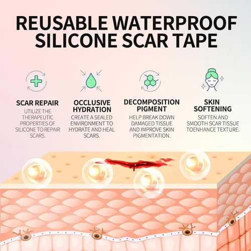 Vista 3 de Hojas de silicona médica para cicatrices, cinta de cicatriz de silicona, cinta de cicatriz reutilizable para cirugía de cesárea, queloides