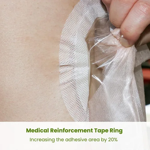 Vista 3 de 20 bolsas de colostomía, bolsas drenables de una pieza para ostomía con cierre para el cuidado del estoma de ileostomía, corte de 15 a 2.362 in