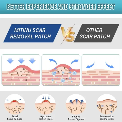 Vista 2 de Hojas de silicona para cicatrices (rollo de 1.6 x 197 pulgadas, 16.4 ft), cinta de silicona profesional para cicatrices, aptas para cicatrices