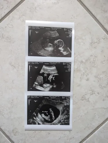 Vista 4 de Broma 2D personalizada tira de ultrasonido falso de 3 fotos