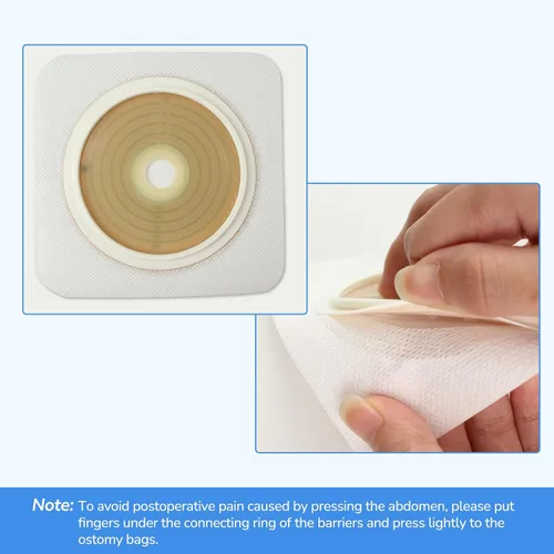 Vista 5 de 10 unidades de barrera cutánea con borde no tejido para bolsas de colostomía de dos piezas, cortadas para ajustar, 2.756 in máx