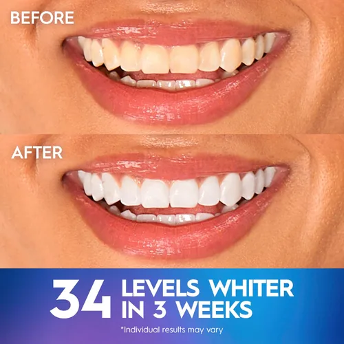 Vista 4 de Crest 3D Whitestrips Efectos Profesionales + Luz LED – Kit de blanqueamiento de dientes, 1 luz + 20 tratamientos, cada uno con 1 superior/1