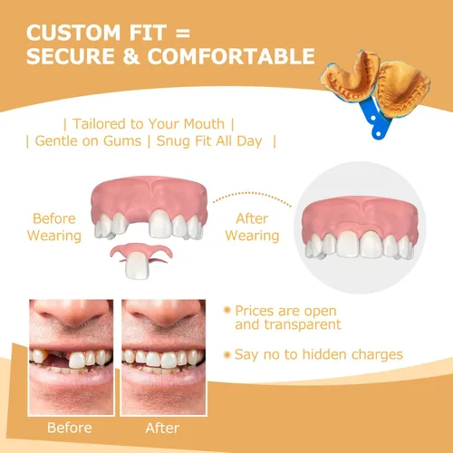 Vista 3 de Prótesis parciales – Dentaduras postizas para dientes perdidos y huecos – Dientes de repuesto ligeros e irrompibles para hombres y mujeres (1 diente)